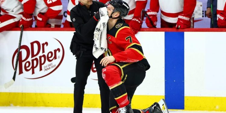 USA hockey star bloodied by big hit in NHL return